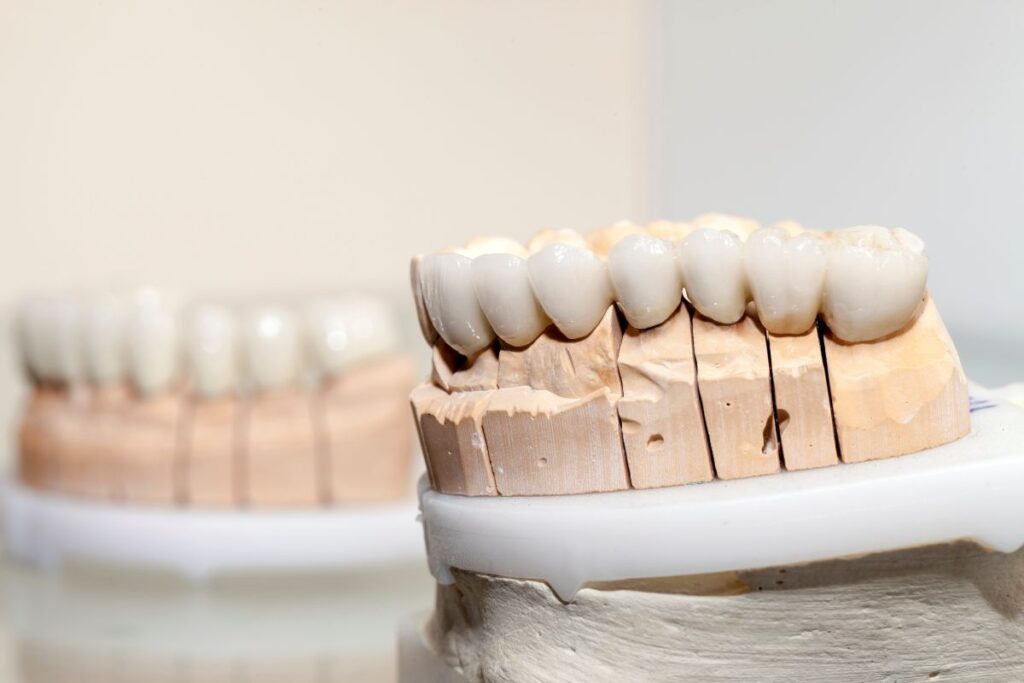 Dental Crowns