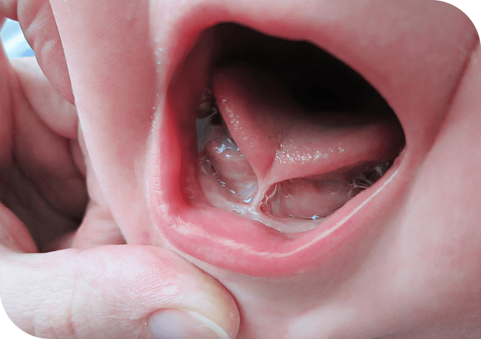 Close-up of a baby's open mouth, with a finger pulling down the lip to show the pink oral cavity and saliva in the throat area.
